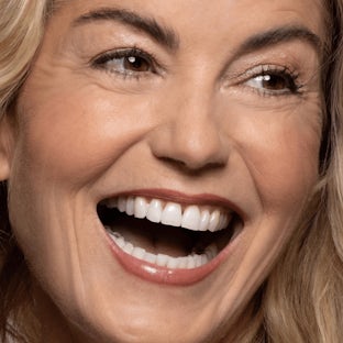 Cell turnover Smiling woman with even skin tone representing the benefits of cell turnover