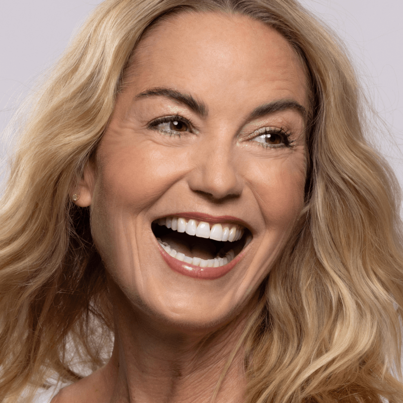 Smiling mature woman, representing the 28 to 50+ age range for Botox treatments